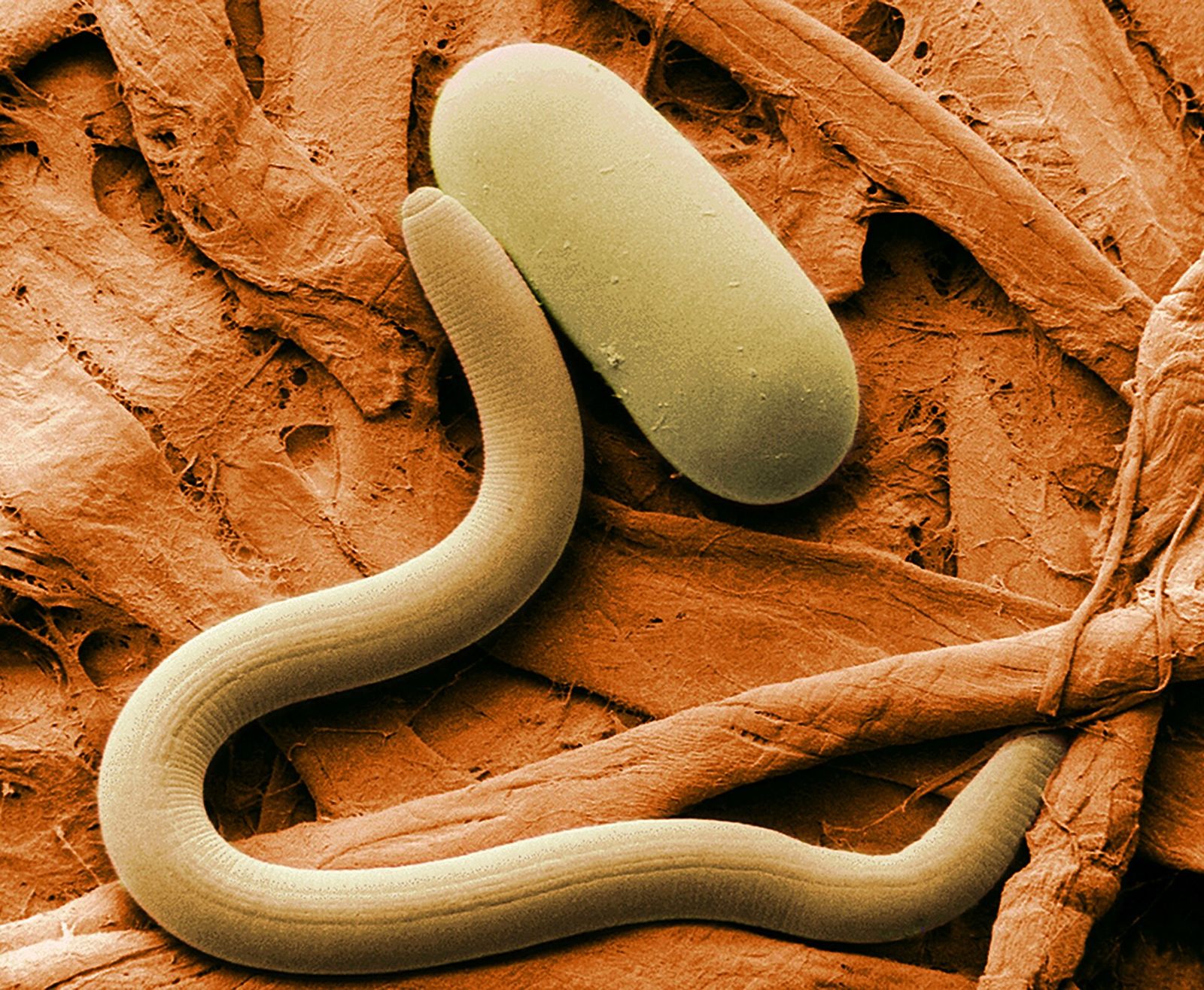 Micrografía electrónica de un nematodo junto a su huevo